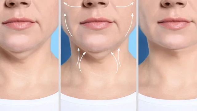4-simple-exercises-to-get-rid-of-your-double-chin-easily