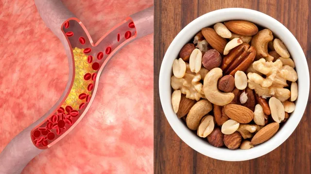 clogged-arteries-5-superfoods-to-include-in-your-diet-to-prevent-plaque