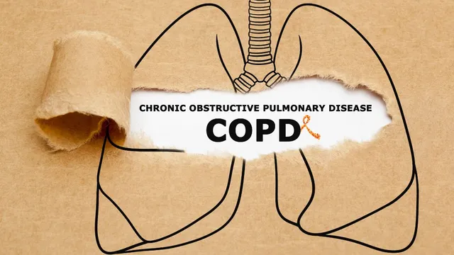 understanding-copd-expert-explains-causes-symptoms-risk-factors-and-treatment