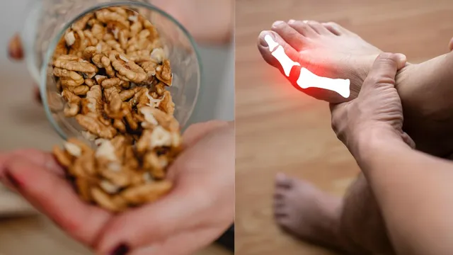 5-winter-foods-that-help-to-reduce-uric-acid-levels-naturally