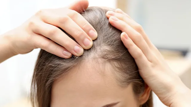 4-simple-ways-to-prevent-hair-thinning-naturally