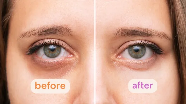 5-simple-home-remedies-to-help-brighten-your-under-eyes-and-get-rid-of-dark-circles-naturally