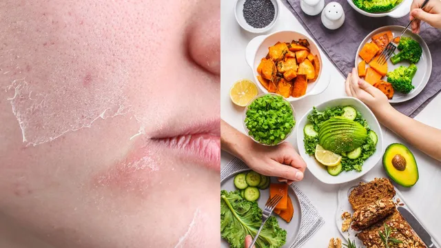 5-superfoods-that-protect-from-skin-dryness-in-winters