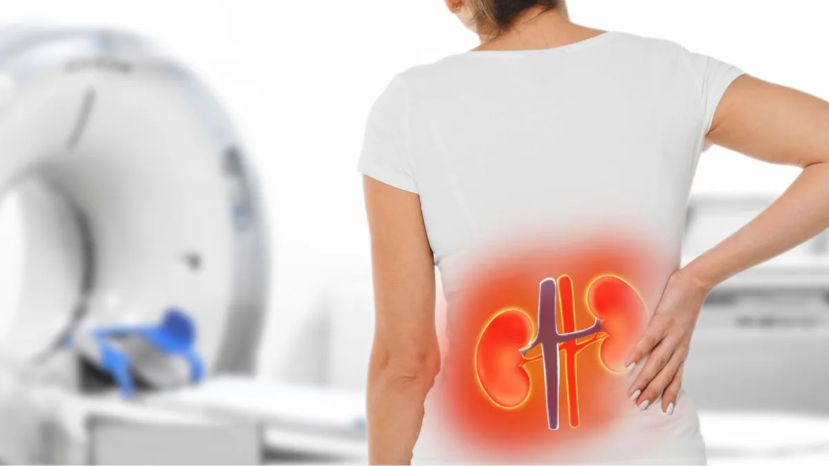 dehydration-and-kidney-stones-why-winter-poses-hidden-risks-to-kidney-health-know-from-expert