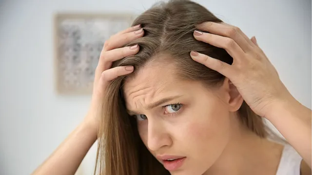 4-effective-ways-to-stop-receding-hairline-naturally