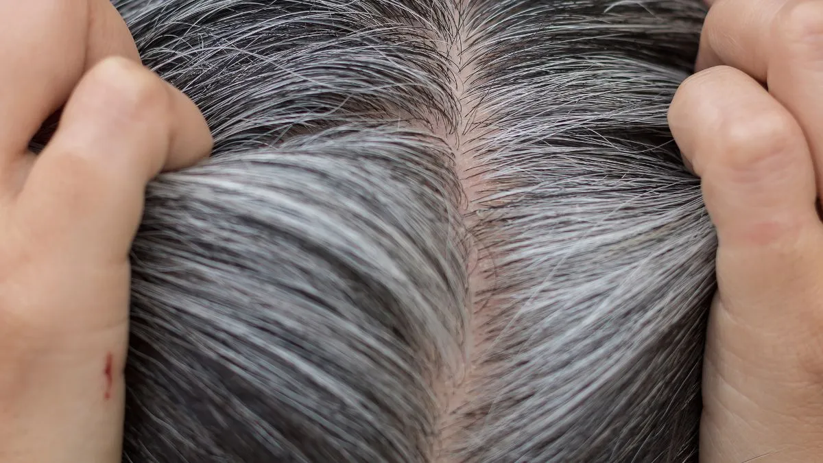 5-simple-ways-to-boost-melanin-in-your-hair-naturally-and-prevent-grey-hair