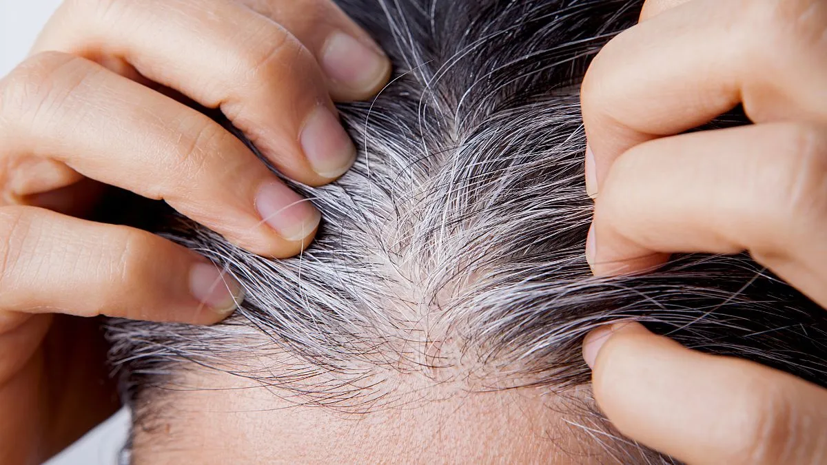 why-your-hair-turning-white-at-an-early-age-know-underlying-reasons