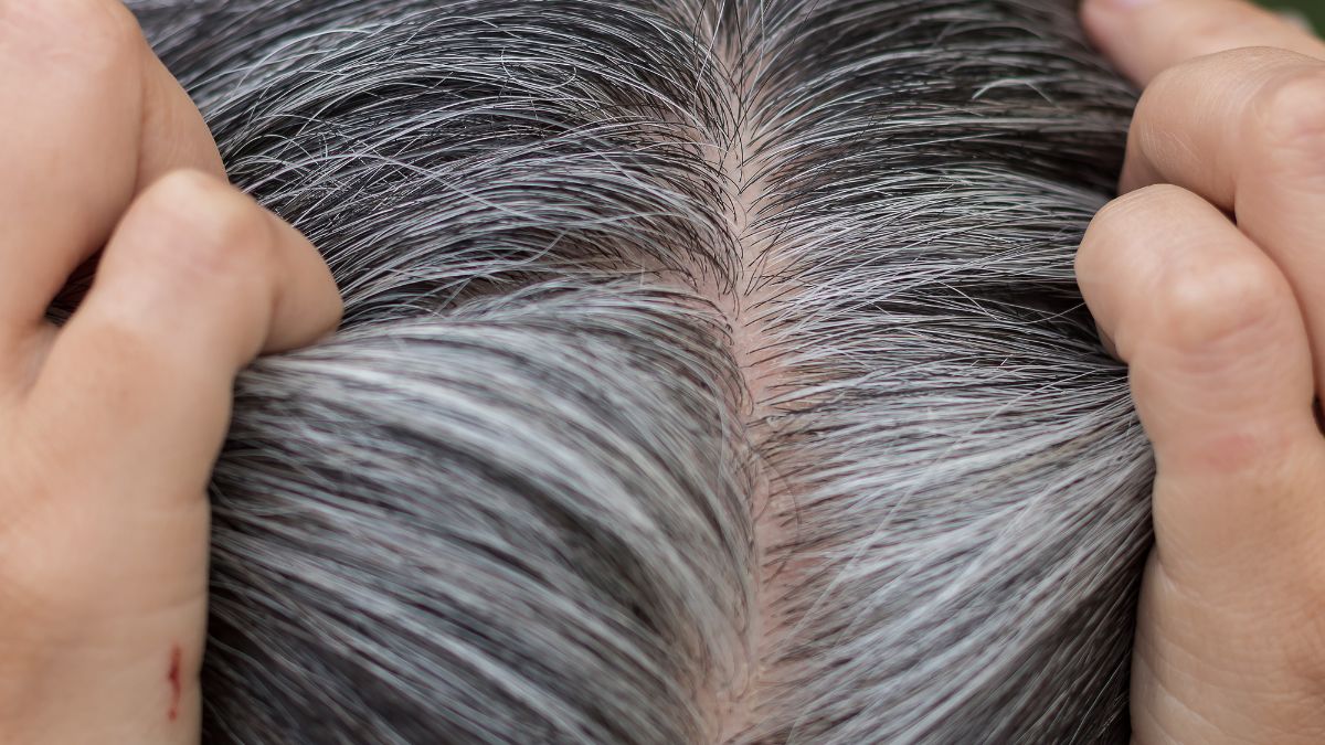 Witnessing Grey Hair At Young Age? Stop Eating These Foods To Avoid