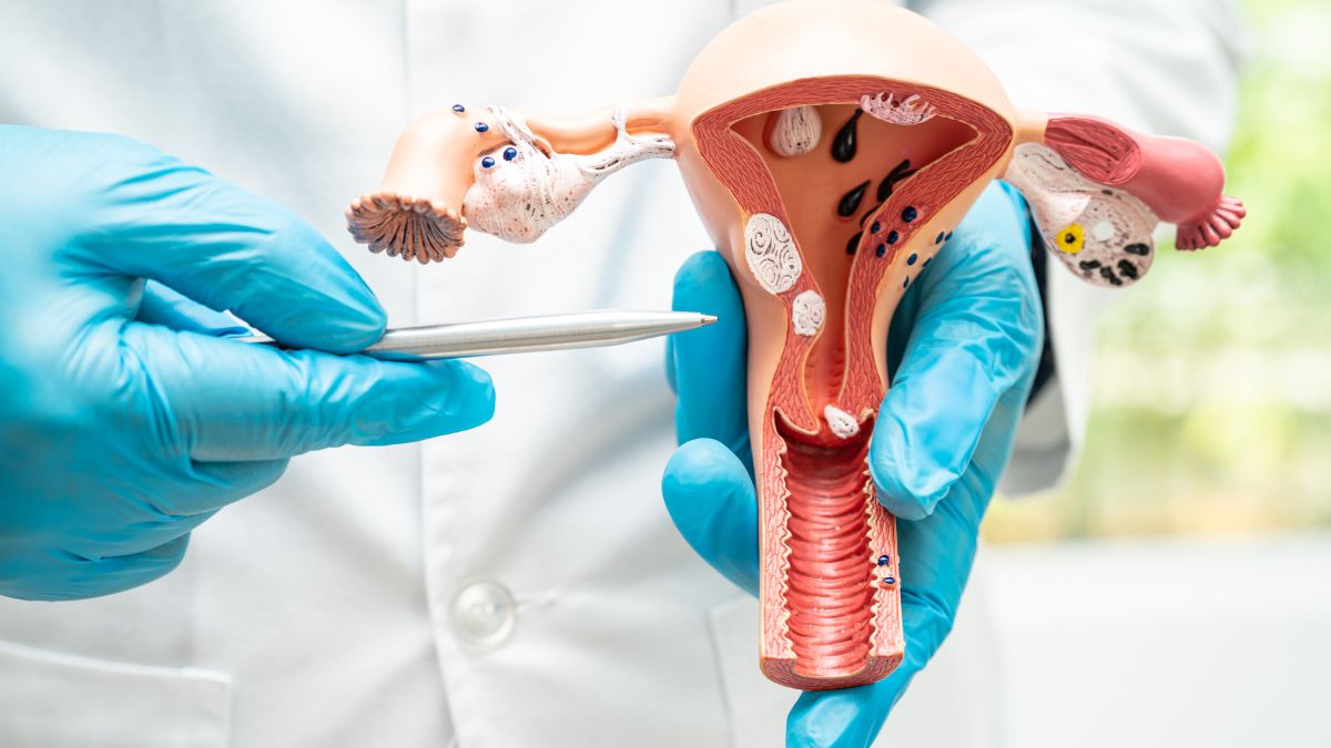 expert-explains-reason-behind-rising-cases-of-cervical-cancer-especially-in-younger-age-groups