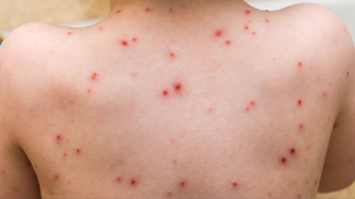 top 10 dangerous viruses in the world's history (2)