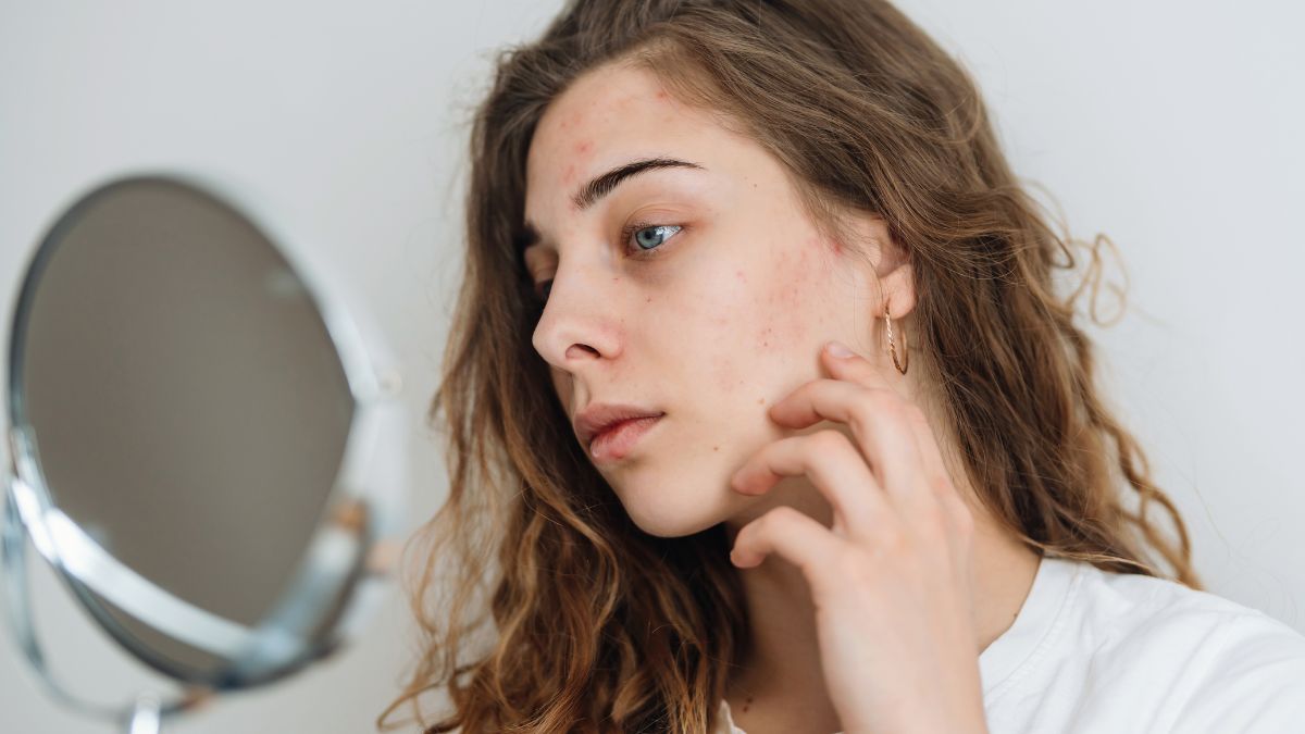 signs of stress on face (1)