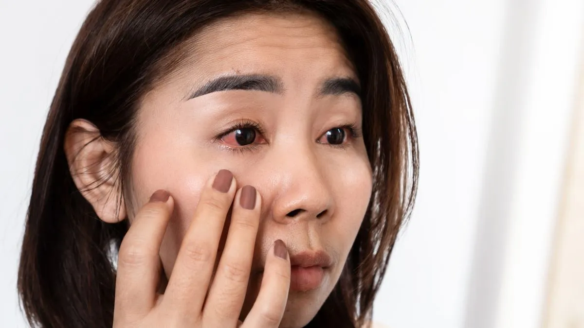 eye-irritation-to-cataracts-doctor-explains-pollution-linked-eye-disorders-you-shouldnt-ignore
