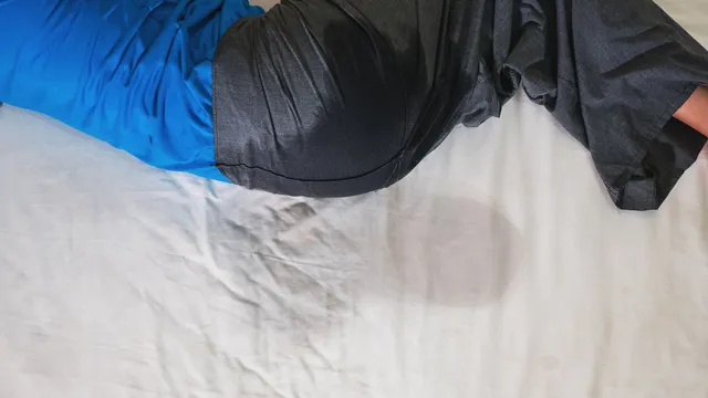 bedwetting-in-children-urologist-explains-bladder-control-in-kids-and-when-to-see-doctor