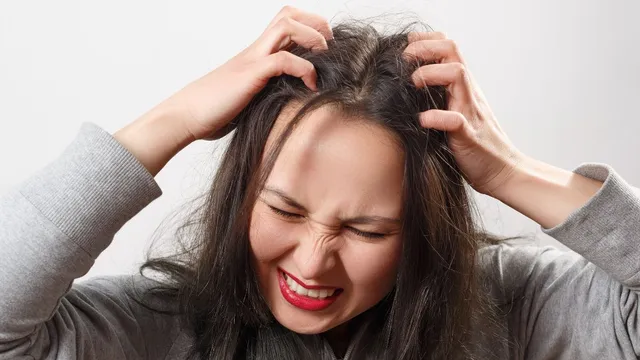 5-easy-ways-to-treat-dry-itchy-and-flaky-scalp-at-home