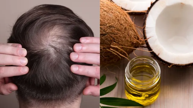 4-natural-oils-to-regrow-hair-on-your-bald-patches