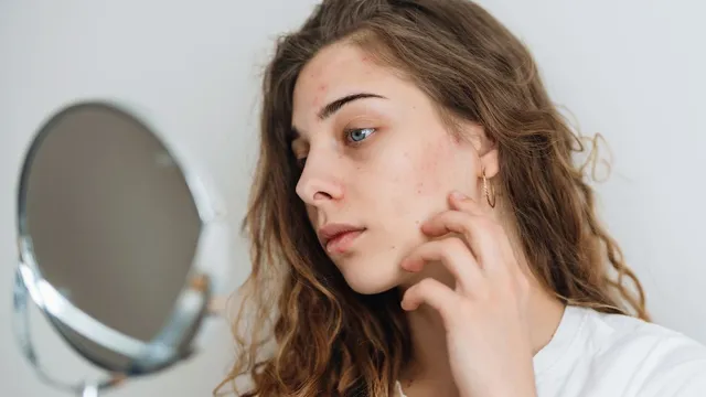 avoid-making-these-skincare-mistakes-to-keep-skin-problems-at-bay