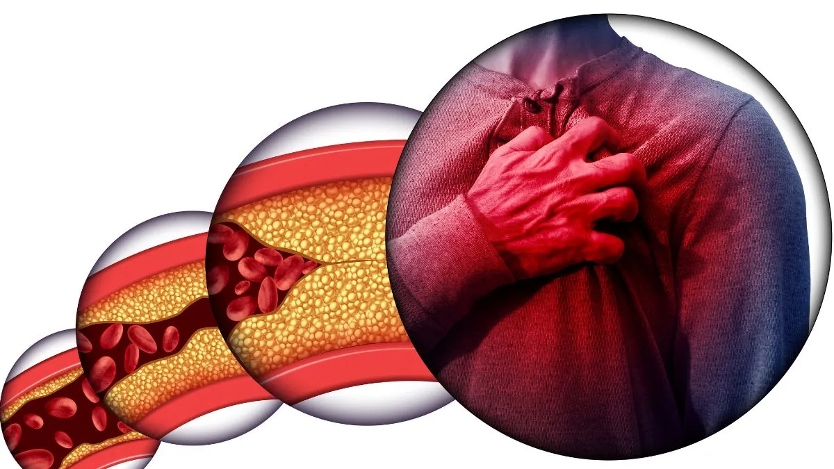 doctor-advise-on-things-you-must-not-do-if-you-have-a-history-of-heart-disease-in-the-family