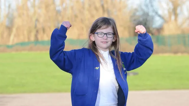 meet-olivia-farnsworth-uks-bionic-girl-who-feels-no-pain-hunger-fatigue-heres-why