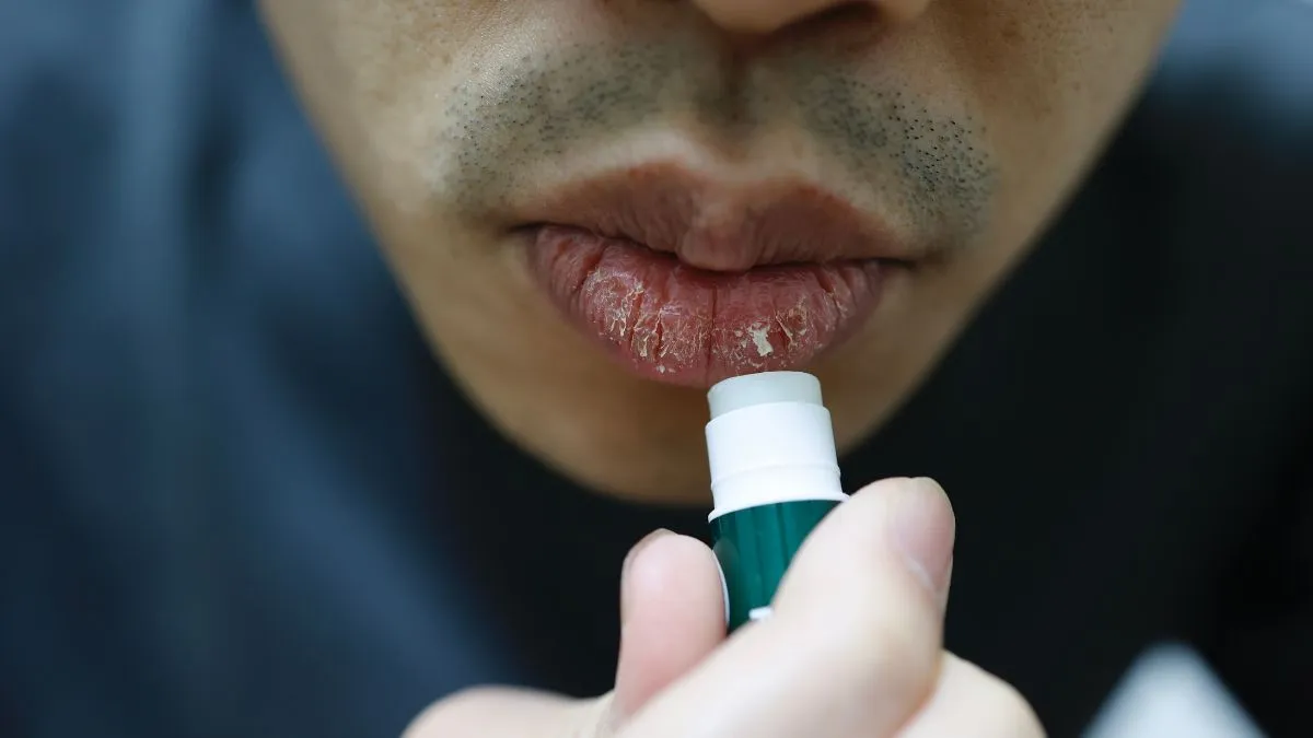 5-ingredients-in-lip-balms-that-cause-dry-and-chapped-lips