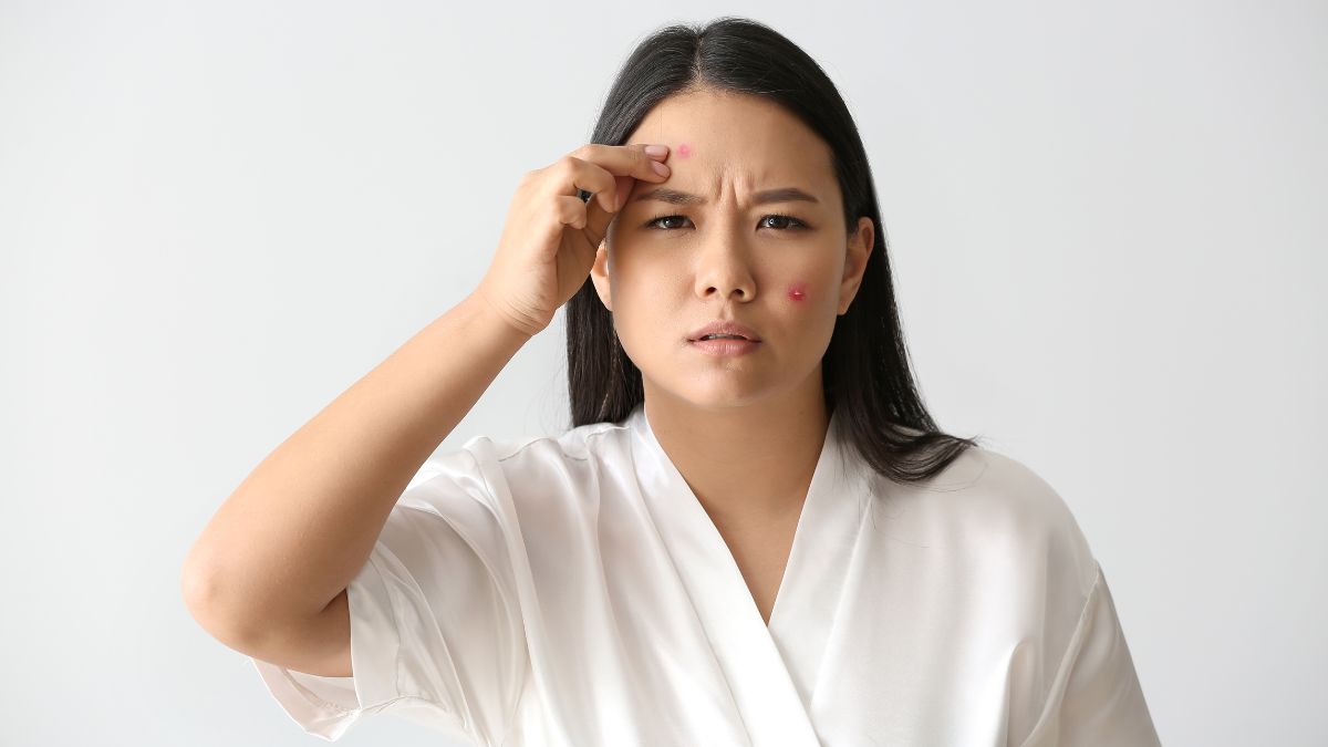 Rubbing Tomatoes On Face Prevent Acne And Pimples