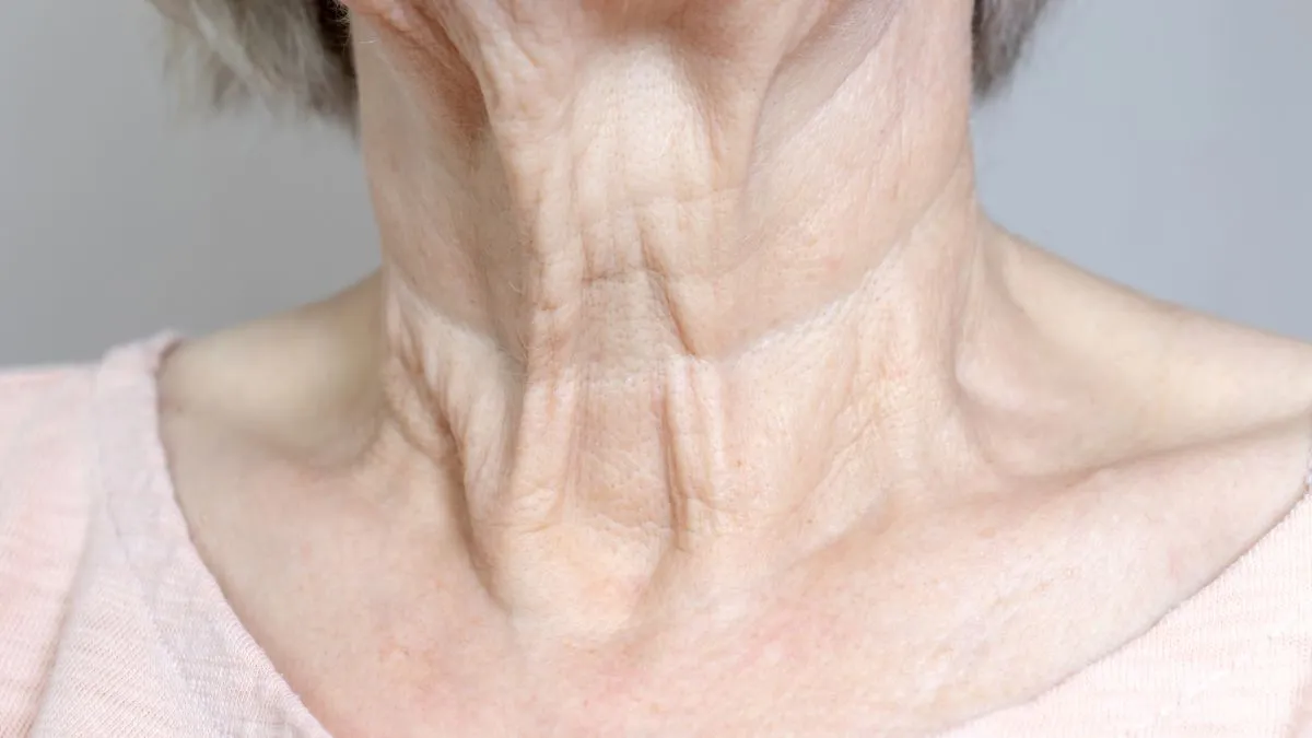 how-to-prevent-neckline-wrinkles-4-tips-to-follow-before-you-enter-your-40s