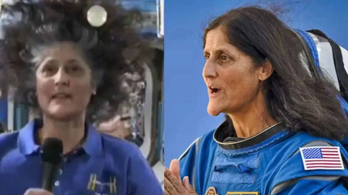 sunita-williams-chin-deformed-due-to-prolonged-stay-in-space-experts-weigh-in