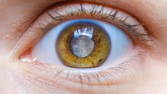 how-airborne-pollutants-are-accelerating-the-development-of-cataracts-expert-explains