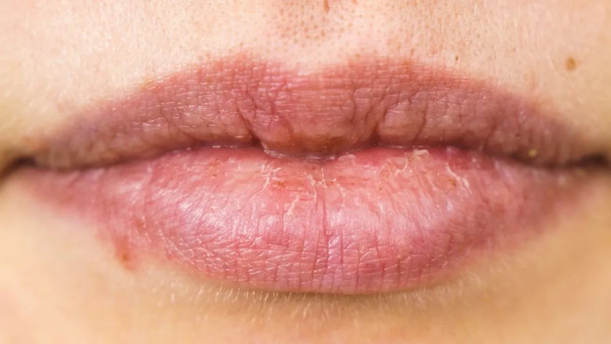 6-home-remedies-to-moisturise-your-dry-and-chapped-lips