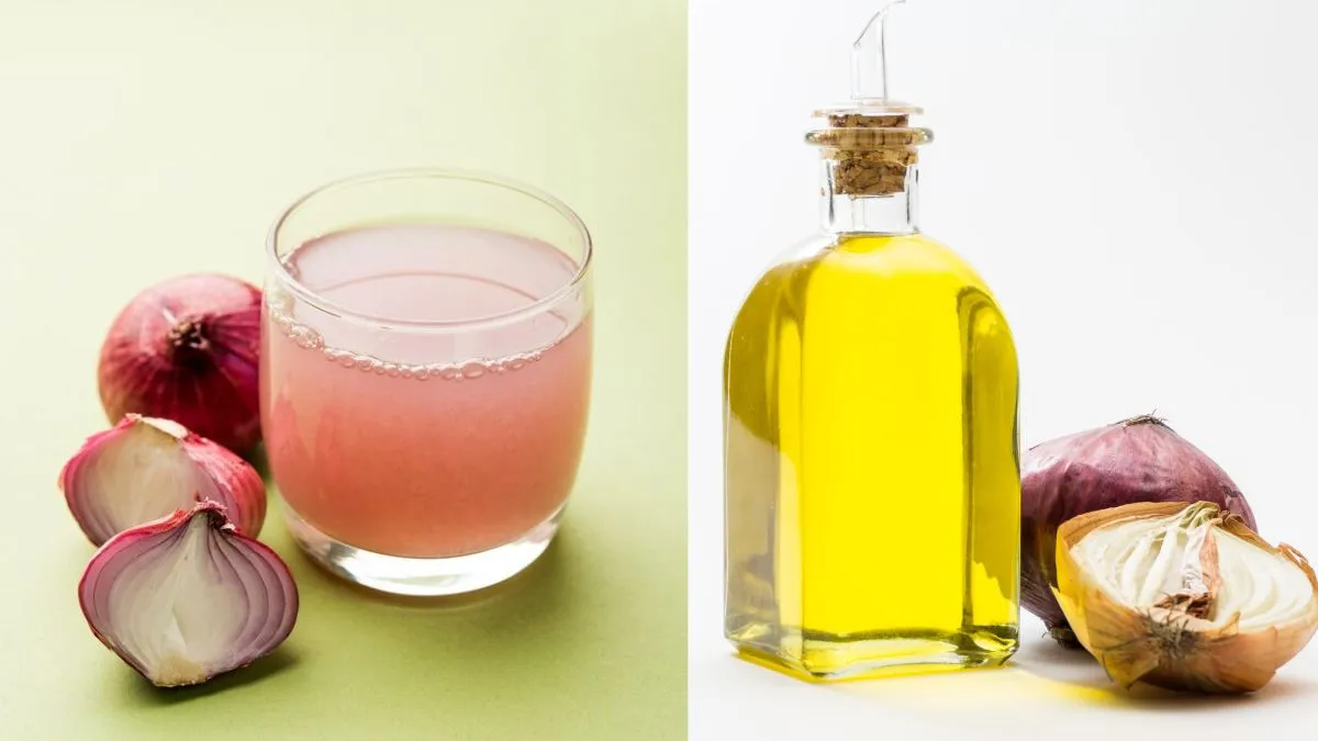 onion-juice-vs-onion-oil-which-is-a-better-choice-for-fast-hair-growth