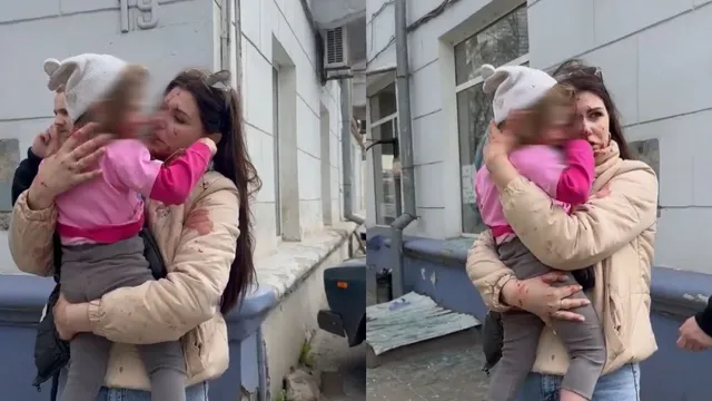 russia-ukraine-war-heartbreaking-video-tearful-mother-cradles-injured-daughter-both-bleeding-from-shattered-glass-after-russian-missile-strike