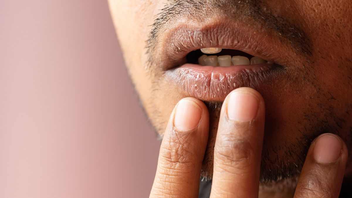 possible causes of dark lips