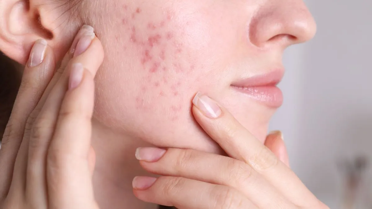 postpartum-skincare-and-haircare-guide-dermatologist-shares-tips-to-tackle-beauty-woes-after-pregnancy