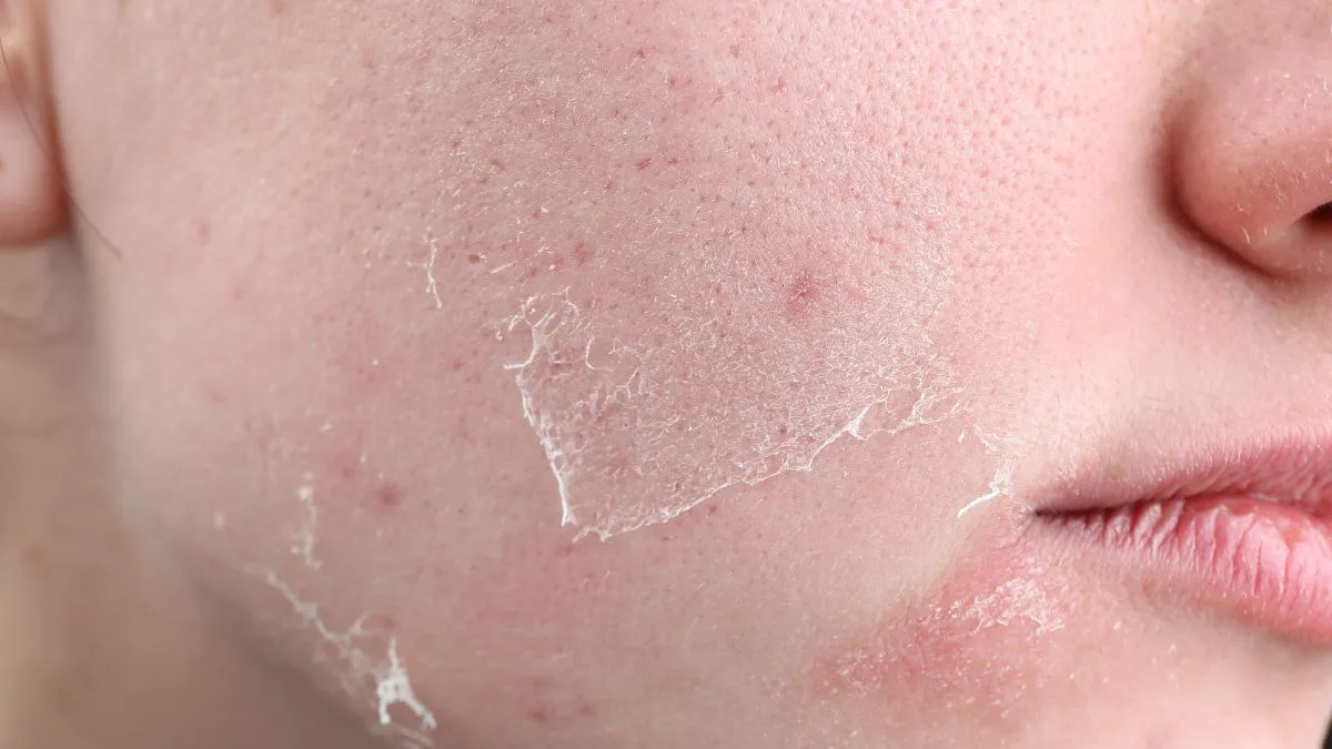 what-is-caveman-skincare-all-about-no-soap-trend-to-achieve-healthy-skin