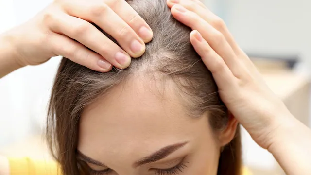 5-powerful-home-remedies-to-regrow-hair-on-your-bald-spots-and-combat-hair-fall