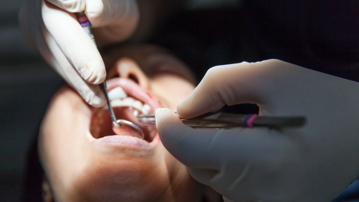 Oral Cancer (1)