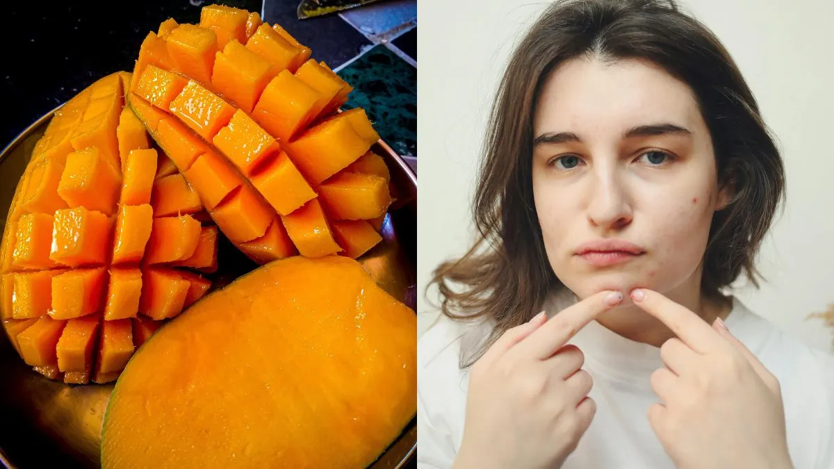 can-eating-mangoes-really-give-you-pimples-heres-what-you-should-know