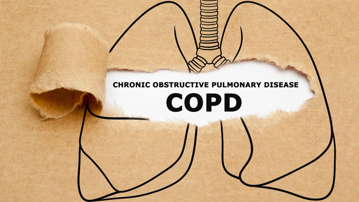What Is Chronic Obstructive Pulmonary Disease? Doctor Shares Strategies To Control Flare-Ups And Exacerbations Caused By COPD
