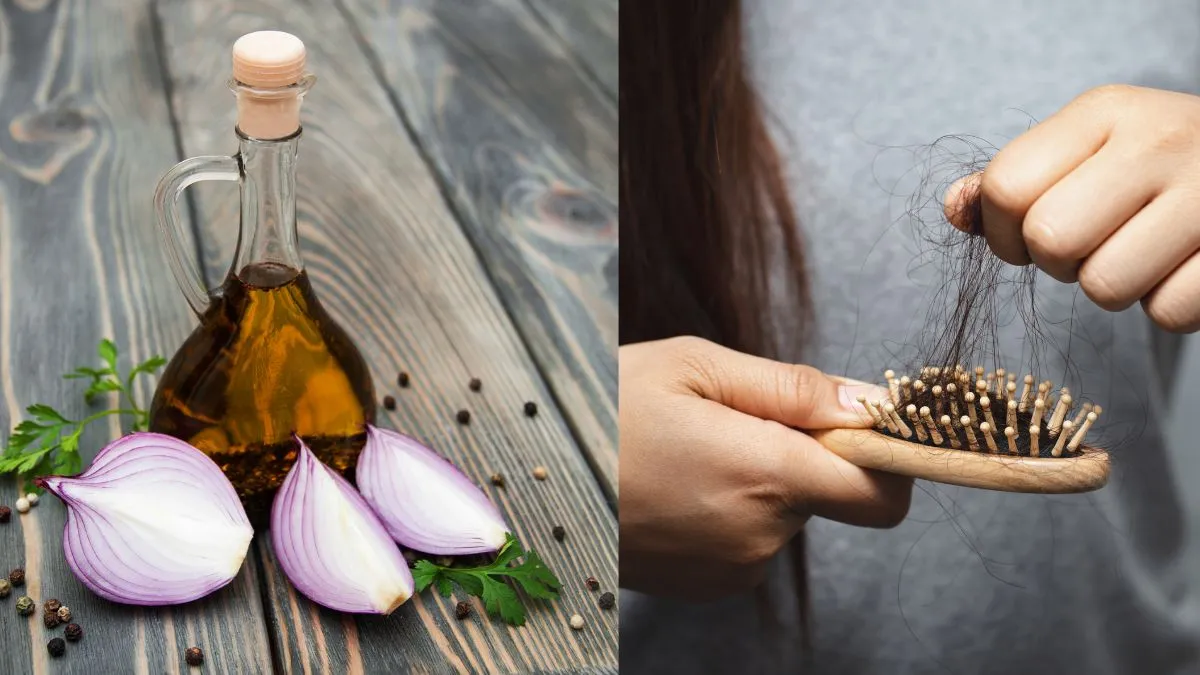 diy-homemade-onion-hair-oil-to-banish-hair-fall-naturally-in-7-days