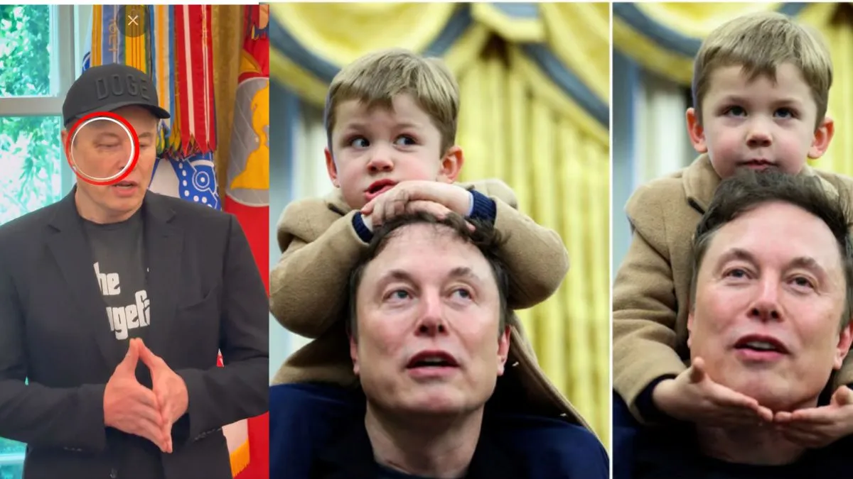 'Asked To Punch Me In The Face, And He Did': Musk Reveals Black Eye After Playtime With Son | SEE PICS