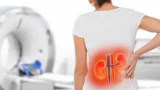 Kidney Disease Symptoms Women Shouldn’t Ignore: Doctor Shares Early Warning Signs