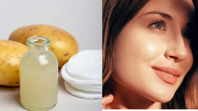 5-best-diy-ways-to-use-potato-at-home-for-clear-bright-and-glowing-skin