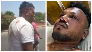 Miracle: Ahmedabad Plane Crash Lone Survivor, Vishwash Kumar Ramesh, Seen Walking Moments After Tragedy | Video