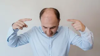 What Are 5 Common Hair Mistakes That Lead To Premature Balding?