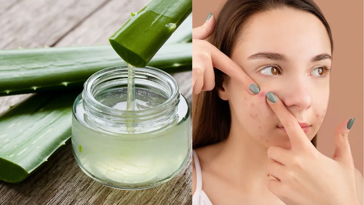 what-are-the-8-most-powerful-home-remedies-to-say-goodbye-to-pimples-naturally