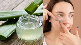 What Are The 8 Most Powerful Home Remedies To Say Goodbye To Pimples Naturally?