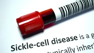Why Sickle Cell Disease Needs Policy Priority And Public Compassion: Know From Doctor