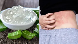 What 6 Natural Remedies Actually Work For Itchy Skin Rash?