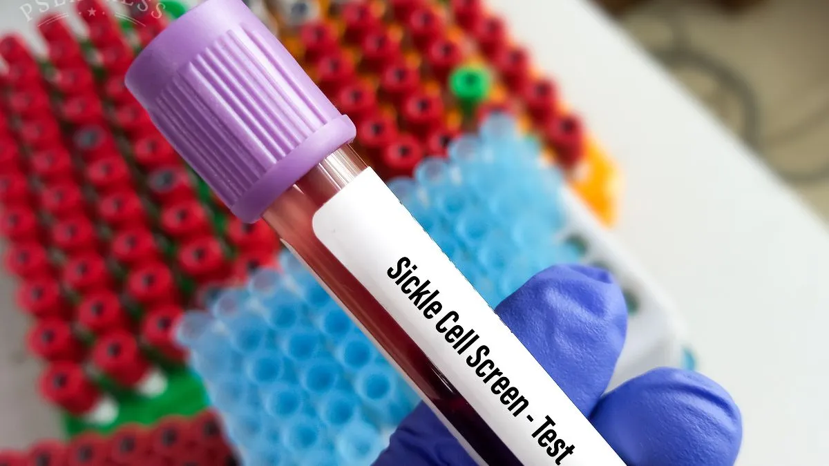 doctor-shares-6-things-everyone-should-know-about-sickle-cell-disease
