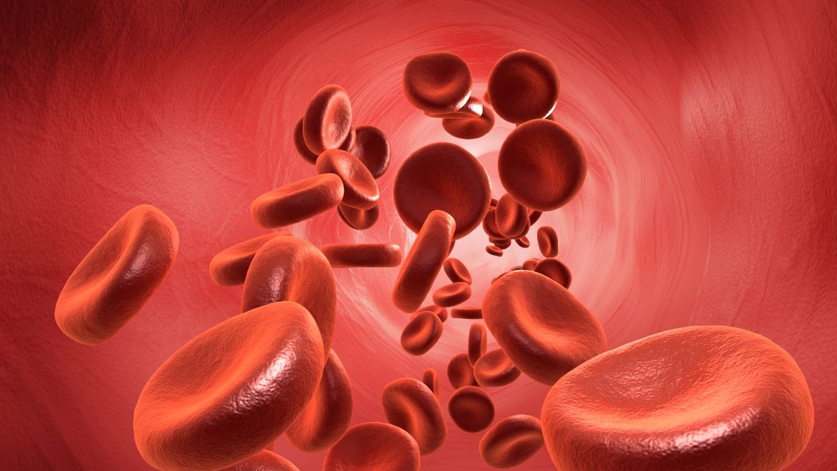 sickle cell