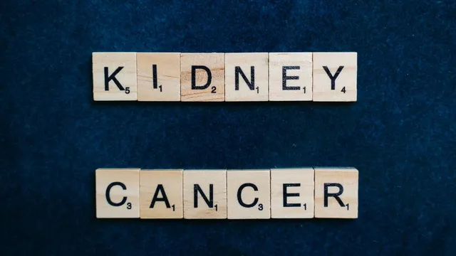 why-do-most-kidney-cancers-go-undetected-until-its-too-late-know-from-doctor